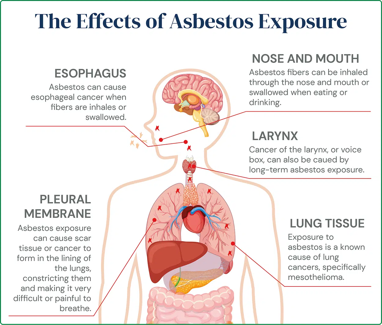 the effects of asbestos exposure chart