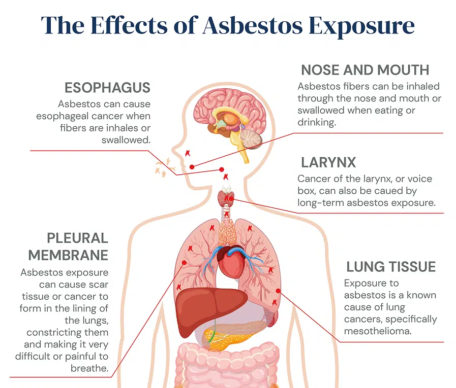 Asbestos Exposure: Updated March 2026